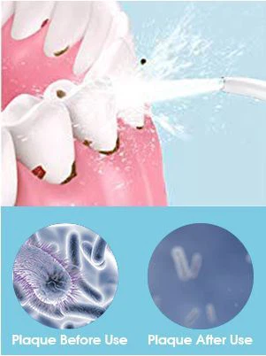 keep your teeth health